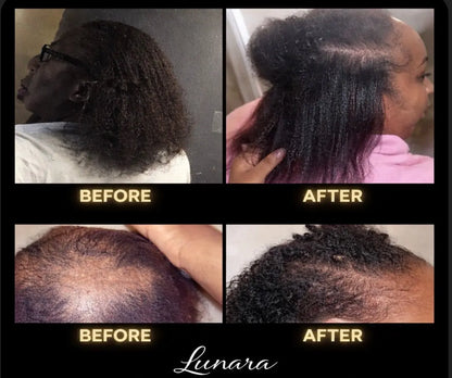 Lunara Crown Revival™
Advanced Hair Growth Elixir 𝒍𝒖𝒏𝒂𝒓𝒂