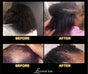 Lunara Crown Revival™
Advanced Hair Growth Elixir 𝒍𝒖𝒏𝒂𝒓𝒂